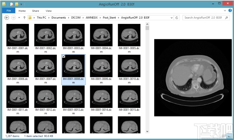 dicom thumbnailer(dicom缩略图查看工具 v1.7.0 官方版